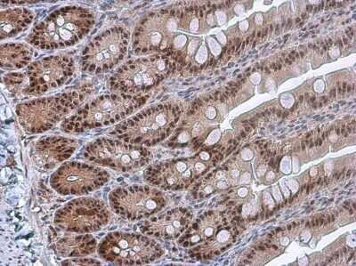 Immunohistochemistry-Paraffin: PDCD4 [p Ser457] Antibody [NBP3-13143]